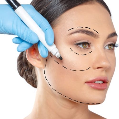 medicina-estetica-hilos-tensores-01_thumbnail