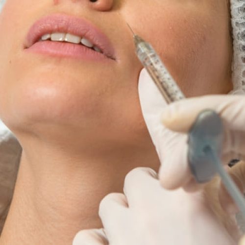 medicina-estetica-relleno-pomulos-01_thumbnail